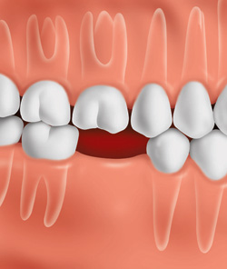 Dalal Dental Care - Dr. Alpa Dalal DDS