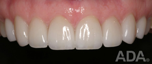 Dalal Dental Care
