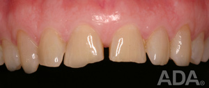 Dalal Dental Care