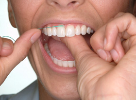 Dalal Dental Care - Flossing