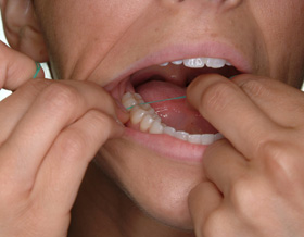 Dalal Dental Care - Flossing