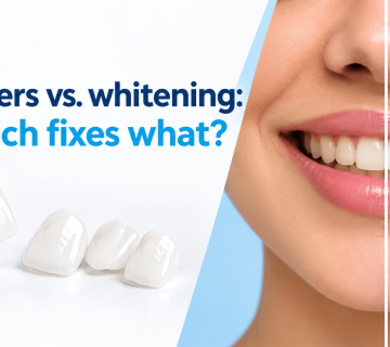 Best dentist in pleasanton